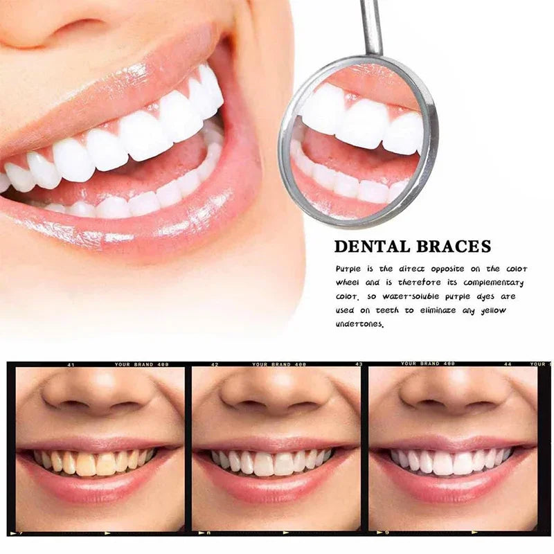 Smilekit V34 Purple Toothpaste: Your Gateway to Radiant, Brighter, Whiter Smiles