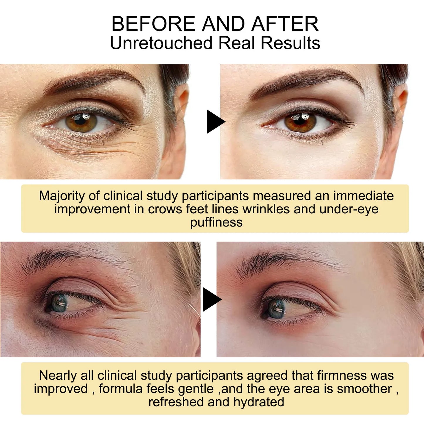 Eye Care Cream for Anti-Wrinkle, Circles, Bags, and Puffy Eyes, Removing Fine Lines