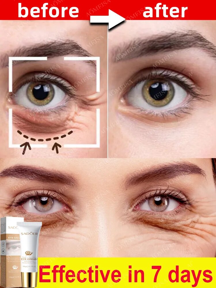 Eye Care Cream for Anti-Wrinkle, Circles, Bags, and Puffy Eyes, Removing Fine Lines