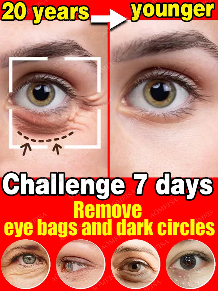 Eye Care Cream for Anti-Wrinkle, Circles, Bags, and Puffy Eyes, Removing Fine Lines