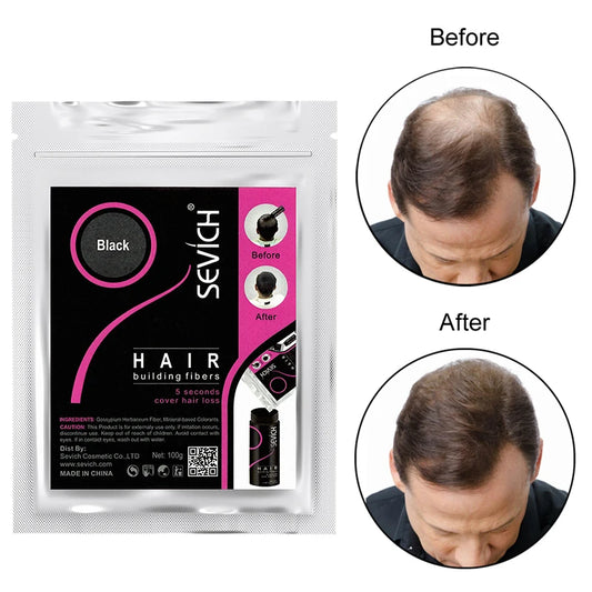 Sevich 100g Hair Fibers Refill Bag Bald Extension