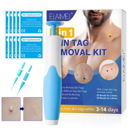 Painless Skin Tag & Wart Removal Kit