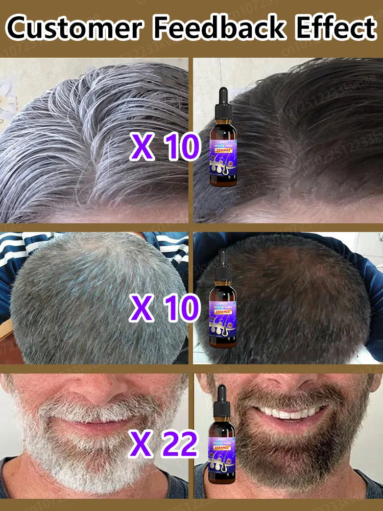 Gray Hair Treatment Serum, Repair Nourishing, Anti-Hair Loss Care Men Women