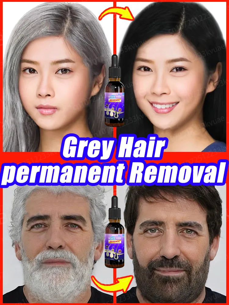 Gray Hair Treatment Serum, Repair Nourishing, Anti-Hair Loss Care Men Women