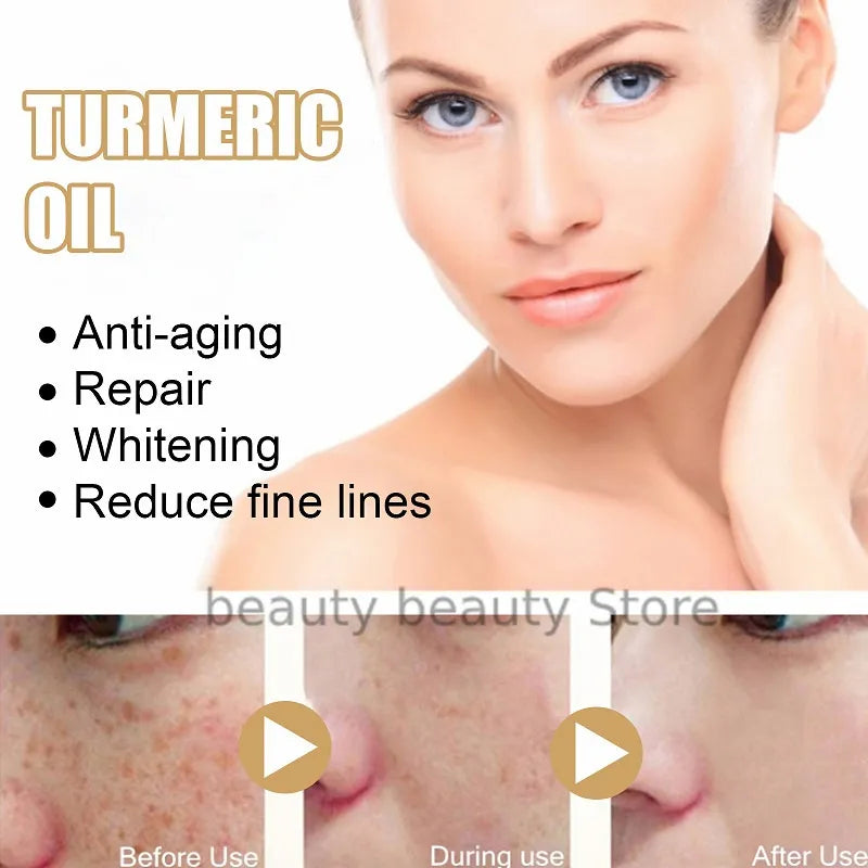 Turmeric Oil Skin To Lightening Acne Dark Patches