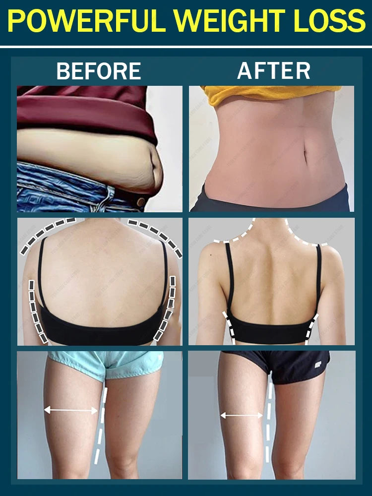 Slimming Cream Fat Burning  Full Body Sculpting Man 7 Days Powerful Weight Loss Woman Fast Belly