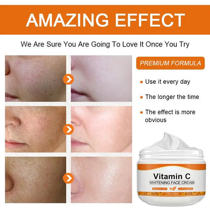 Dark Spot Whitening Vitamin C Face Cream