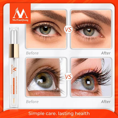 Eyelash Growth Serum Enhancer- Natural Medicine