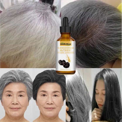 Gray White Hair Treatment Serum, Natural Color Repair Nourish, Anti Loss Hair Care Men & Women Women