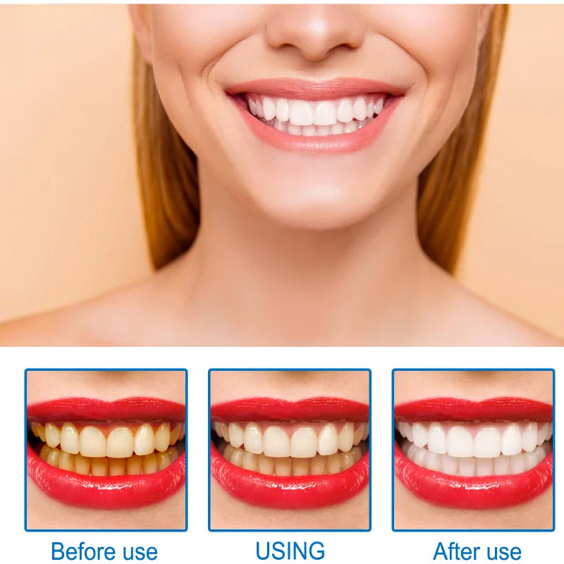 Teeth Whitening Essence Remove Against Dental Caries Plaque Stains Serum Fresh Breath Oral Hygiene Dental Tooth Cleaning Tools