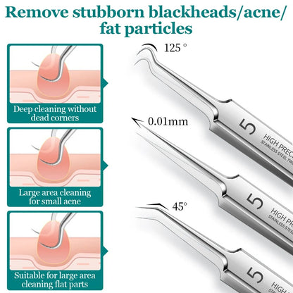 Blackhead Acne Extractor Tool