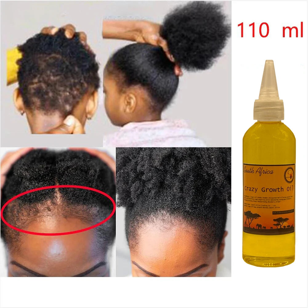 Africa Crazy Hair Growth Oil