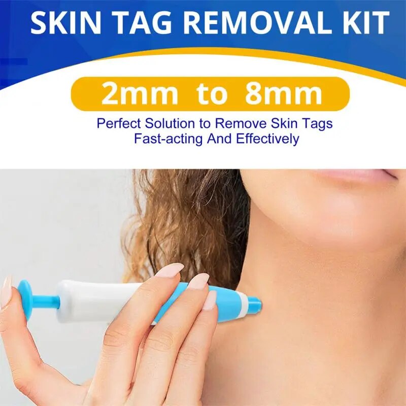 Painless Skin Tag & Wart Removal Kit