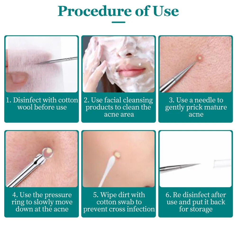 Blackhead Acne Extractor Tool