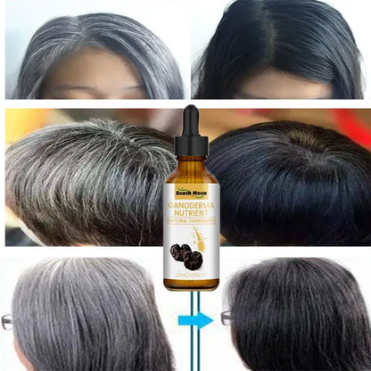 Gray White Hair Treatment Serum, Natural Color Repair Nourish, Anti Loss Hair Care Men & Women Women