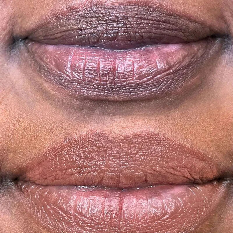 Lip Transformation Gel