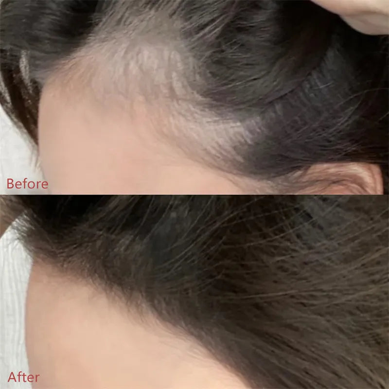 Hairline Root Cover Up  Powder