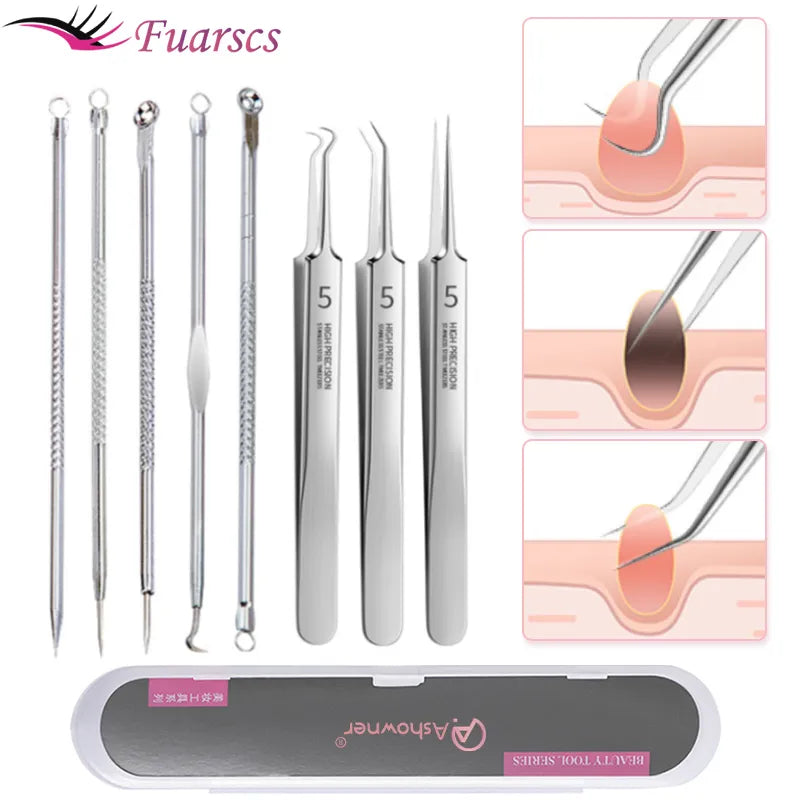 Blackhead Acne Extractor Tool