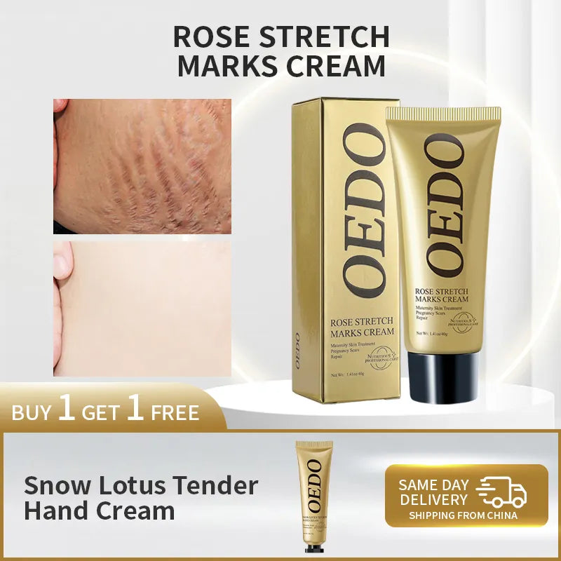 Rose Stretch Mark Cream: Postpartum & Anti-Aging Solution