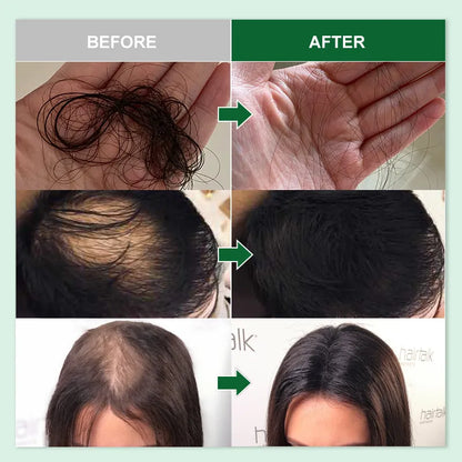 PURC Rosemary Hair Growth & Scalp Care Products