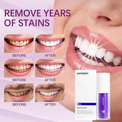 Smilekit V34 Purple Toothpaste: Your Gateway to Radiant, Brighter, Whiter  Smiles