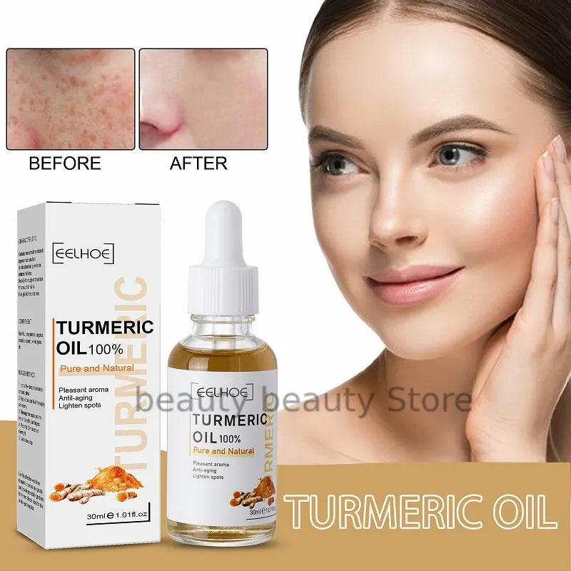 Turmeric Oil Skin To Lightening Acne Dark Patches